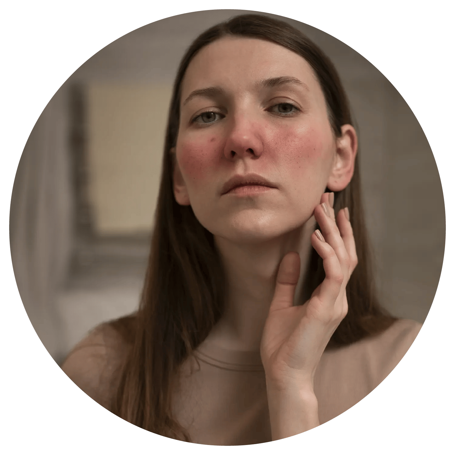 Rosacea treatment results at Toronto medical spa - The Chain Reaction of Symptoms